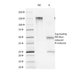 SDS-PAGE - Anti-CD16 Antibody [C16/1045] (A277603) - Antibodies.com