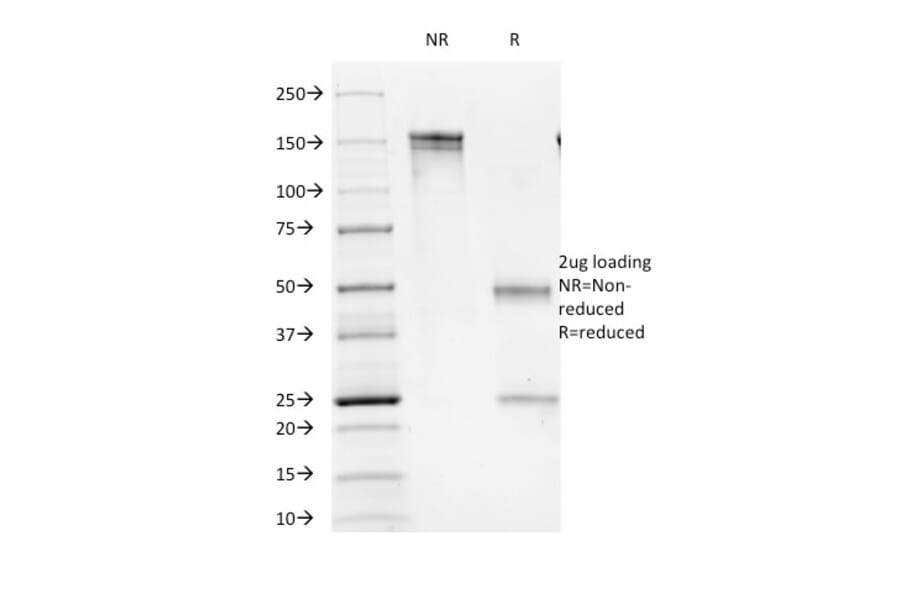 SDS-PAGE - Anti-CD16 Antibody [C16/1045] (A277603) - Antibodies.com