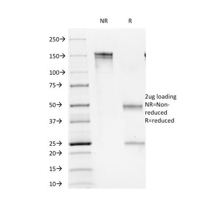 SDS-PAGE - Anti-CD16 Antibody [C16/1045] (A277603) - Antibodies.com