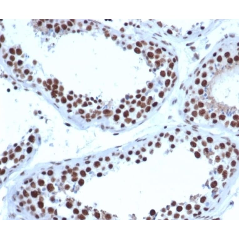 Immunohistochemistry - Anti-JAZF1 Antibody [PCRP-JAZF1-1C2] (A277604) - Antibodies.com