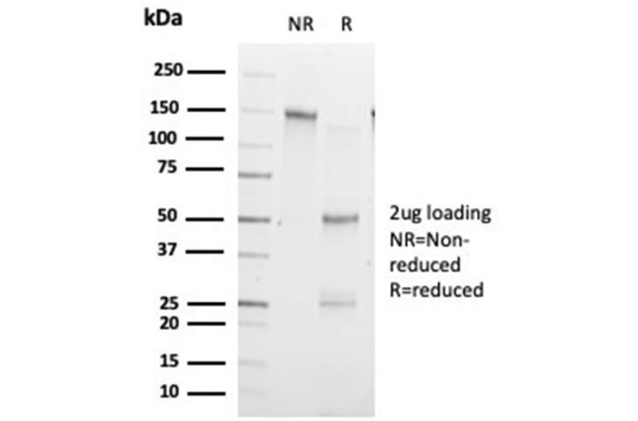 SDS-PAGE - Anti-ZHX3 Antibody [PCRP-ZHX3-1G3] (A277607) - Antibodies.com