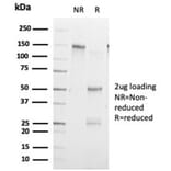 SDS-PAGE - Anti-ZHX3 Antibody [PCRP-ZHX3-1G3] (A277607) - Antibodies.com