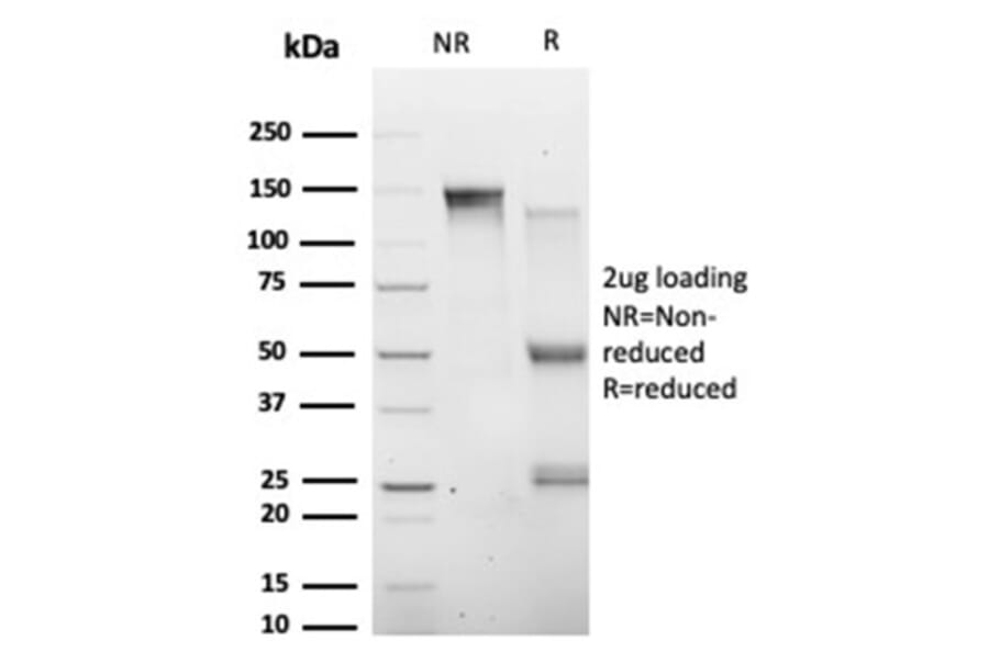 SDS-PAGE - Anti-HIC2 Antibody [PCRP-HIC2-1B1] (A277608) - Antibodies.com