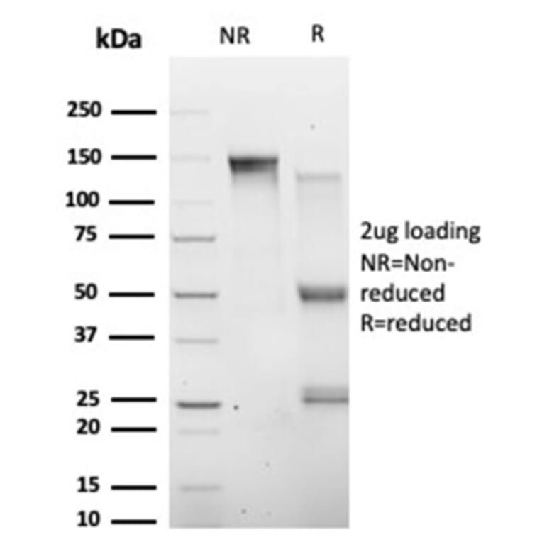 SDS-PAGE - Anti-HIC2 Antibody [PCRP-HIC2-1B1] (A277608) - Antibodies.com