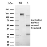 SDS-PAGE - Anti-HIC2 Antibody [PCRP-HIC2-1B1] (A277608) - Antibodies.com