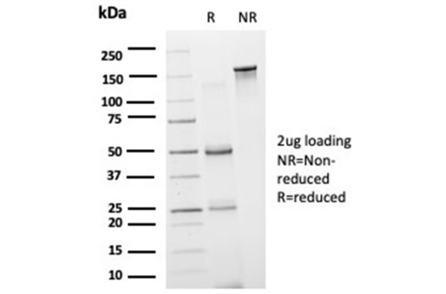 SDS-PAGE - Anti-GRAMD4 Antibody [PCRP-GRAMD4-1A10] (A277610) - Antibodies.com