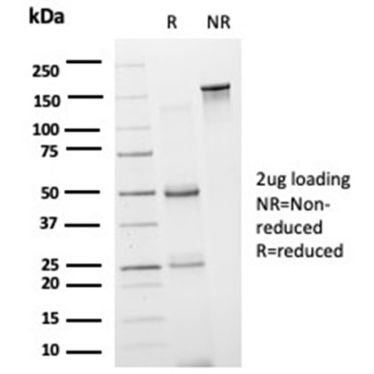 SDS-PAGE - Anti-GRAMD4 Antibody [PCRP-GRAMD4-1A10] (A277610) - Antibodies.com