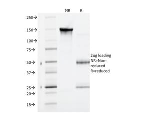 SDS-PAGE - Anti-VEGF Receptor 1 Antibody [FLT1/1663] (A277611) - Antibodies.com