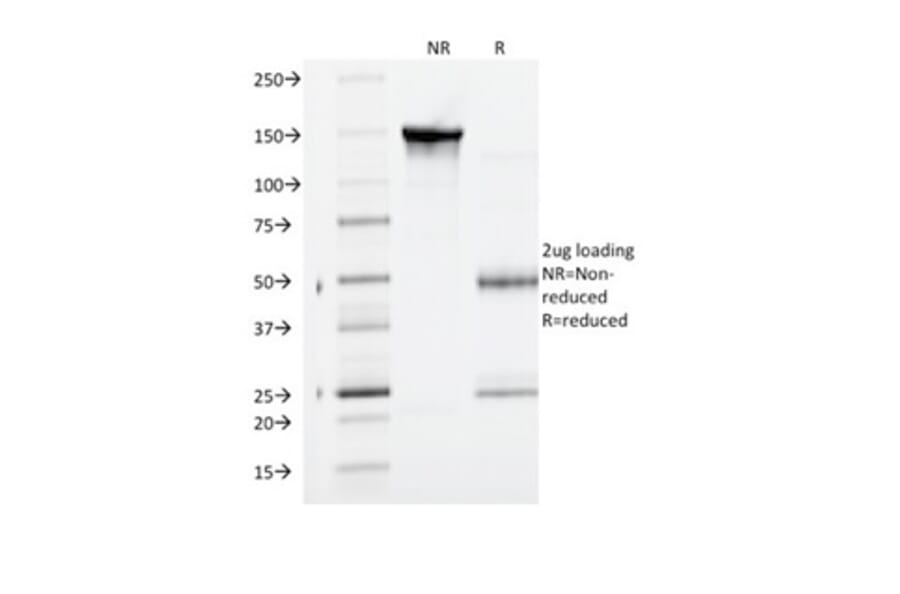 SDS-PAGE - Anti-VEGF Receptor 1 Antibody [FLT1/1663] (A277611) - Antibodies.com