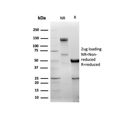 SDS-PAGE - Anti-DBC2 Antibody [DBC2/3361] (A277612) - Antibodies.com
