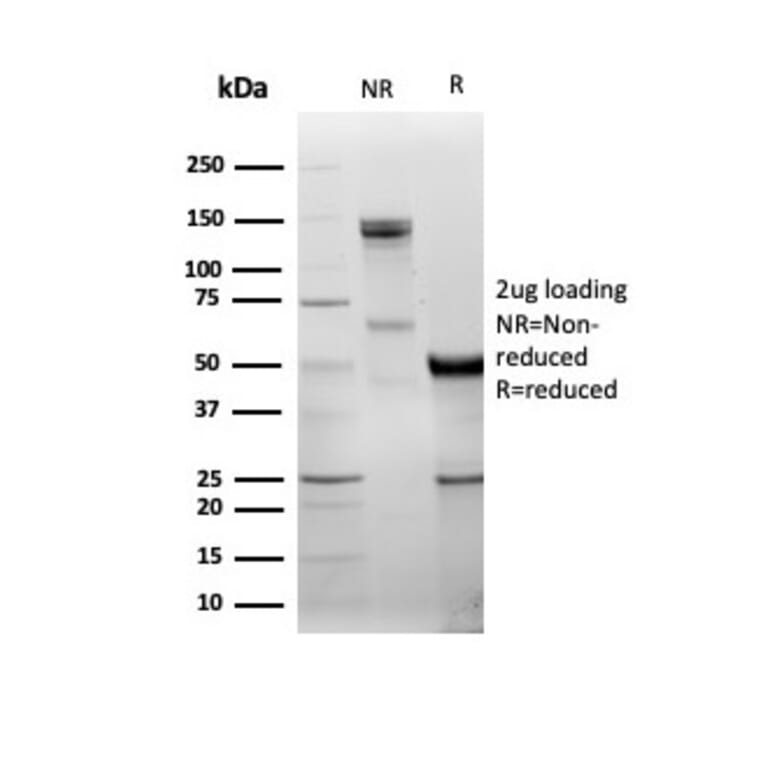 SDS-PAGE - Anti-DBC2 Antibody [DBC2/3361] (A277612) - Antibodies.com