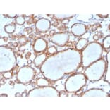 Immunohistochemistry - Anti-DBC2 Antibody [DBC2/3361] (A277612) - Antibodies.com