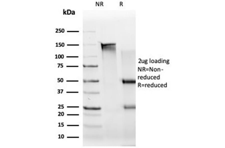 SDS-PAGE - Anti-UBR2 Antibody [PCRP-UBR2-1D12] (A277613) - Antibodies.com