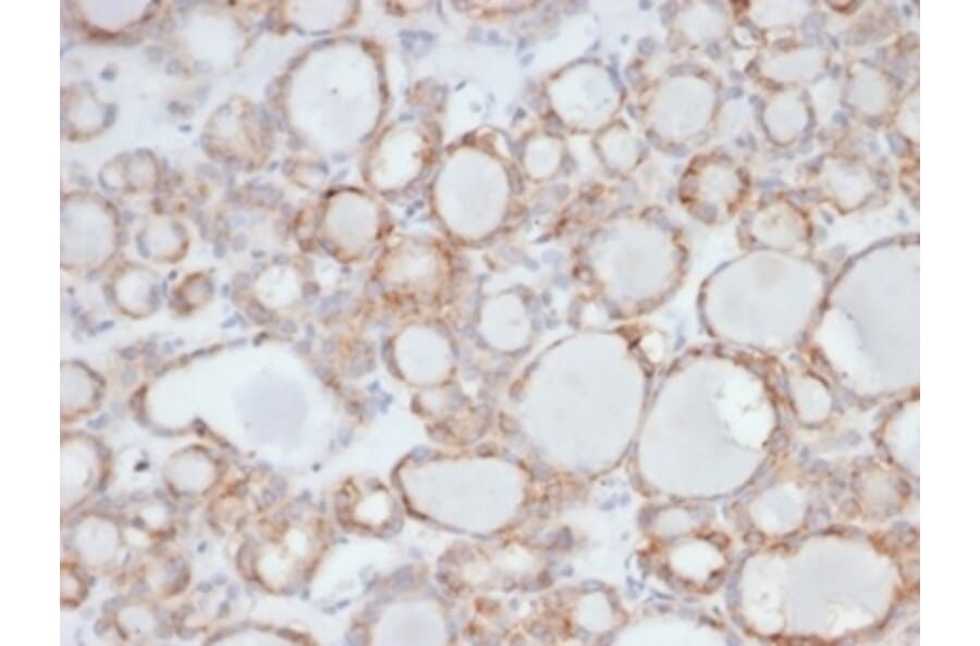 Immunohistochemistry - Anti-UBR2 Antibody [PCRP-UBR2-1D12] (A277613) - Antibodies.com