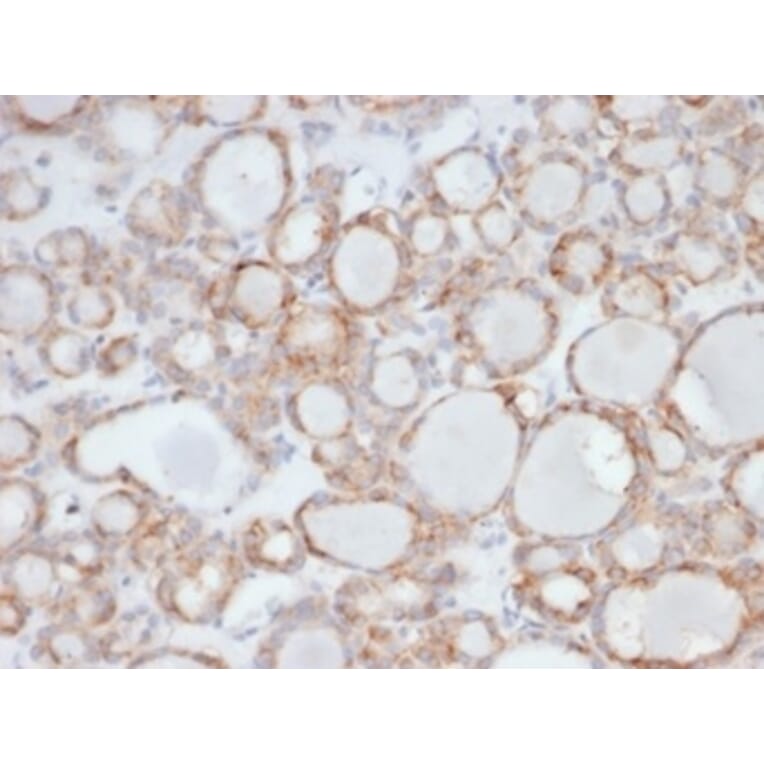 Immunohistochemistry - Anti-UBR2 Antibody [PCRP-UBR2-1D12] (A277613) - Antibodies.com
