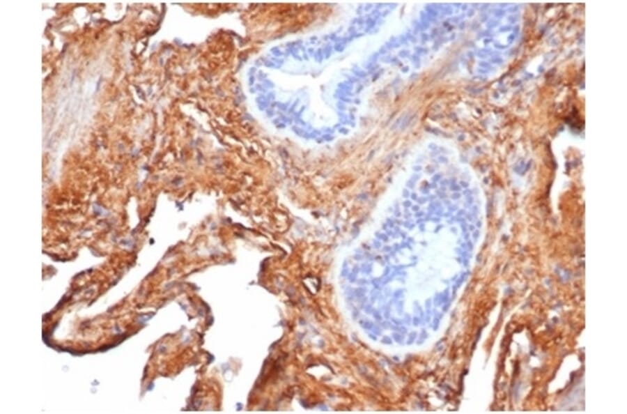 Immunohistochemistry - Anti-Fibronectin Antibody [FN1/3569] (A277614) - Antibodies.com
