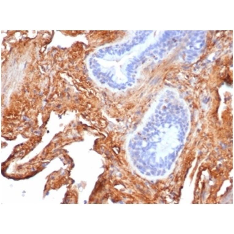 Immunohistochemistry - Anti-Fibronectin Antibody [FN1/3569] (A277614) - Antibodies.com