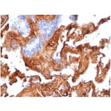 Immunohistochemistry - Anti-Fibronectin Antibody [FN1/3569] (A277614) - Antibodies.com