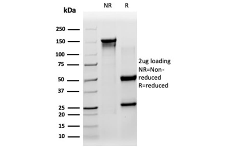 SDS-PAGE - Anti-SIRT3 Antibody [PCRP-SIRT3-1C10] (A277615) - Antibodies.com