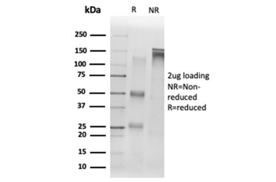 SDS-PAGE - Anti-SIRT1 Antibody [PCRP-SIRT1-1E11] (A277616) - Antibodies.com