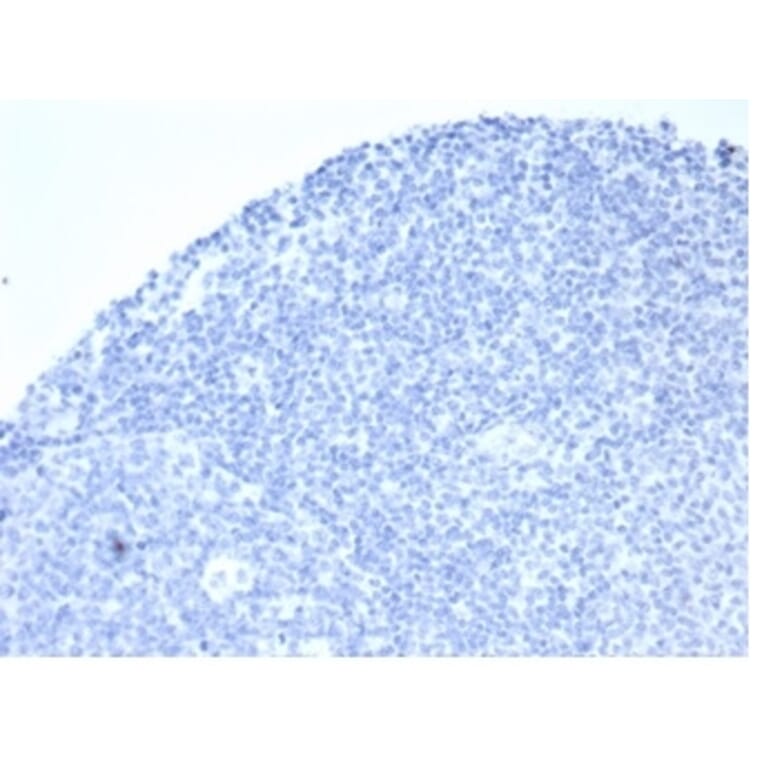Immunohistochemistry - Anti-Placental Alkaline Phosphatase Antibody [rALP/870] (A277617) - Antibodies.com