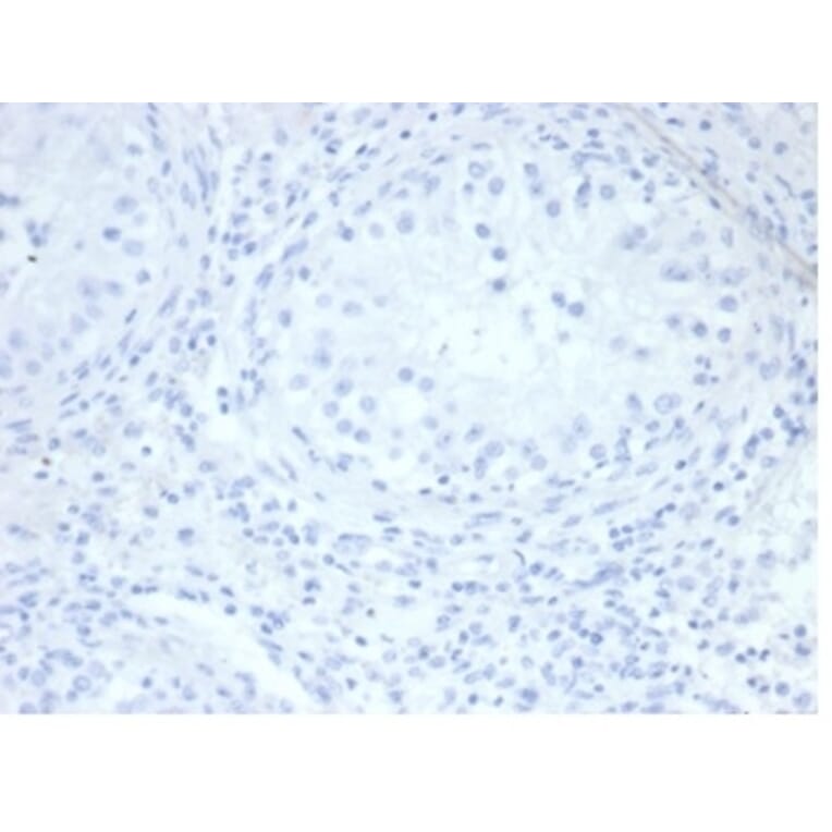 Immunohistochemistry - Anti-Placental Alkaline Phosphatase Antibody [rALP/870] (A277617) - Antibodies.com