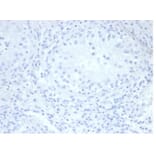 Immunohistochemistry - Anti-Placental Alkaline Phosphatase Antibody [rALP/870] (A277617) - Antibodies.com