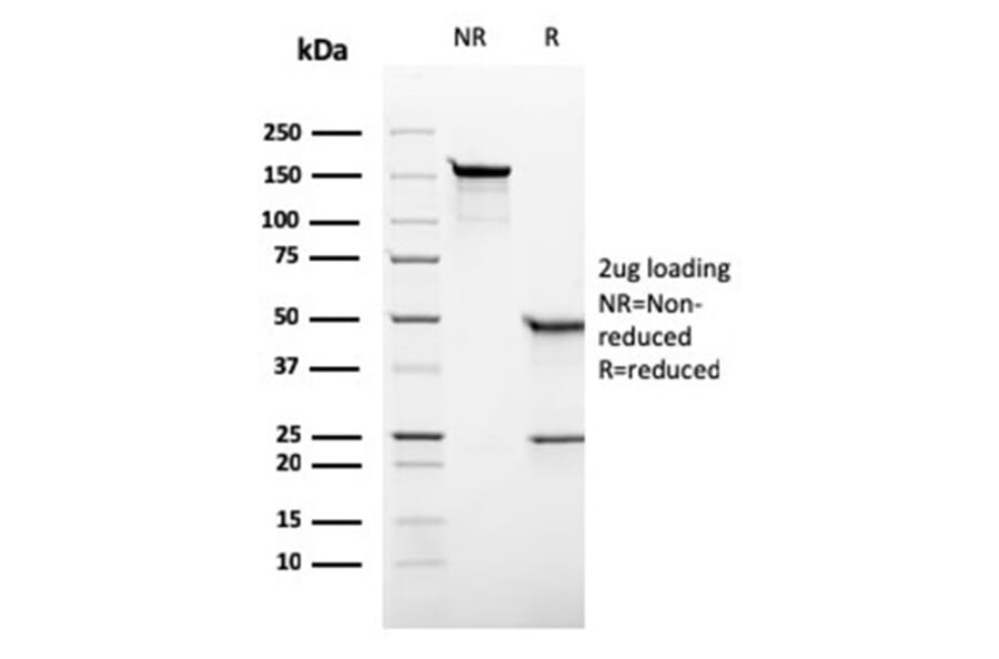 SDS-PAGE - Anti-Placental Alkaline Phosphatase Antibody [rALP/870] (A277617) - Antibodies.com