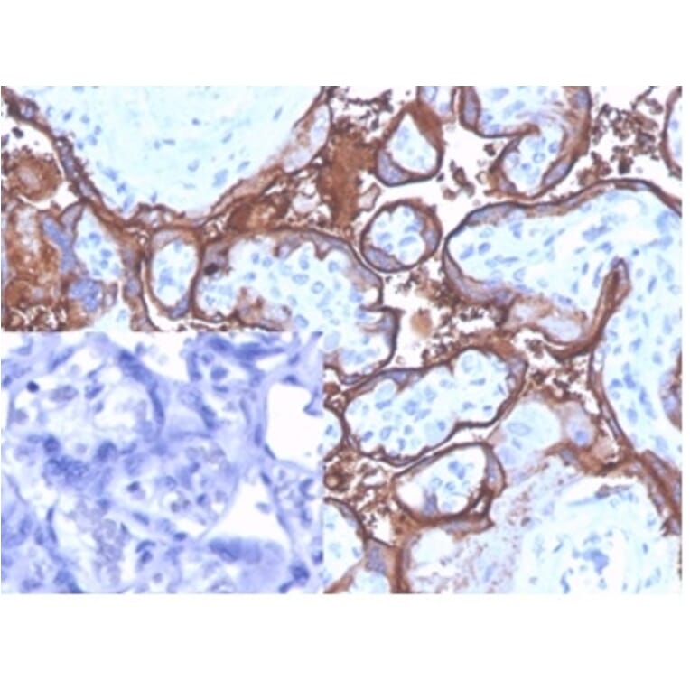 Immunohistochemistry - Anti-Placental Alkaline Phosphatase Antibody [ALPP/4109] (A277618) - Antibodies.com