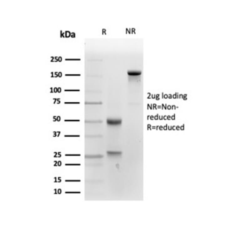 SDS-PAGE - Anti-Placental Alkaline Phosphatase Antibody [ALPP/4109] (A277618) - Antibodies.com