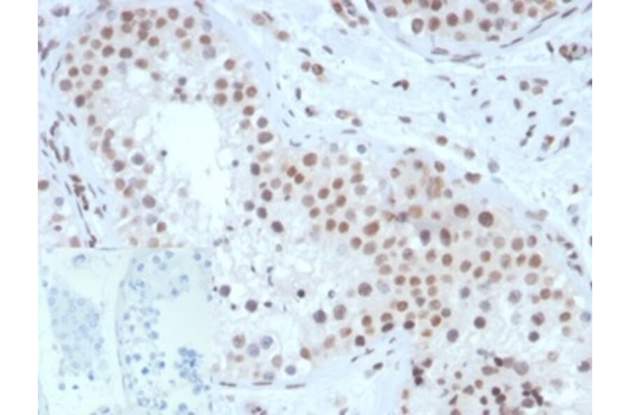 Immunohistochemistry - Anti-Steroidogenic Factor 1 Antibody [NR5A1/3420] (A277619) - Antibodies.com