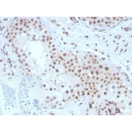 Immunohistochemistry - Anti-Steroidogenic Factor 1 Antibody [NR5A1/3420] (A277619) - Antibodies.com