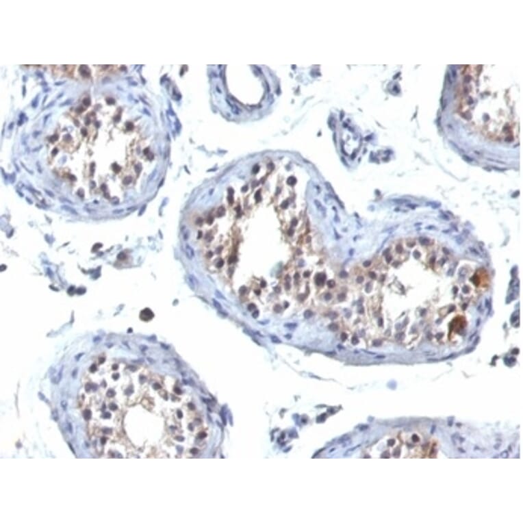 Immunohistochemistry - Anti-GCET2 Antibody [HGAL/830] (A277620) - Antibodies.com