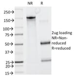 SDS-PAGE - Anti-GCET2 Antibody [HGAL/830] (A277620) - Antibodies.com