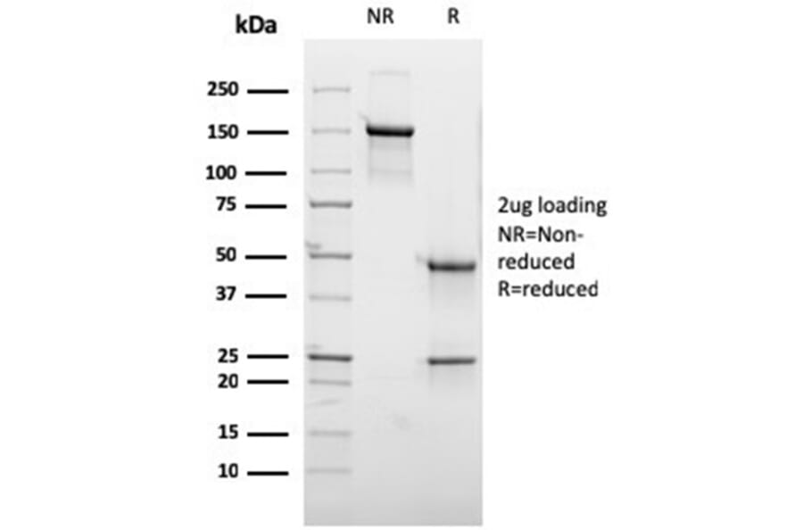 SDS-PAGE - Anti-GCET2 Antibody [HGAL/2373] (A277621) - Antibodies.com