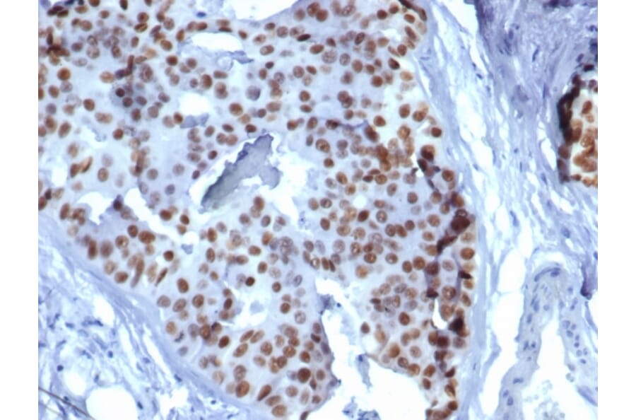 Immunohistochemistry - Anti-GATA3 Antibody [GATA3/6664] (A277623) - Antibodies.com