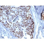 Immunohistochemistry - Anti-GATA3 Antibody [GATA3/6664] (A277623) - Antibodies.com