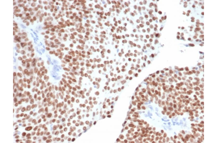 Immunohistochemistry - Anti-GATA3 Antibody [GATA3/6664] (A277623) - Antibodies.com