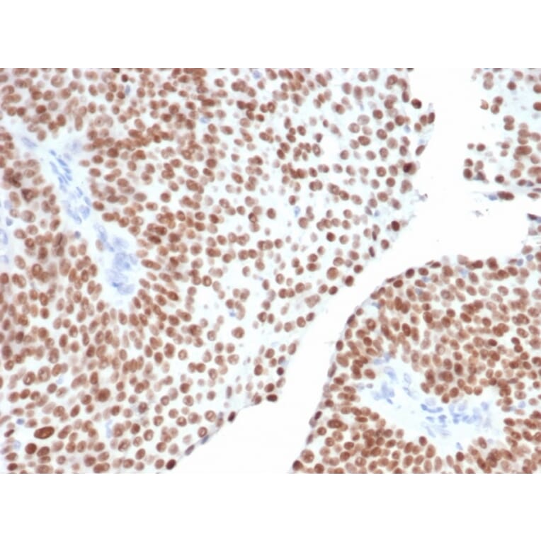 Immunohistochemistry - Anti-GATA3 Antibody [GATA3/6664] (A277623) - Antibodies.com