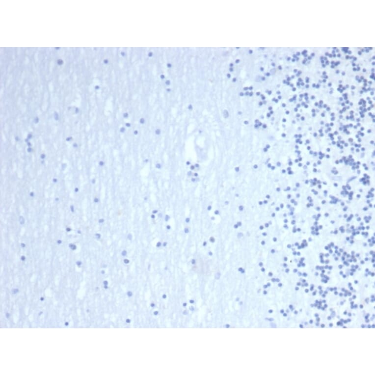 Immunohistochemistry - Anti-GATA3 Antibody [GATA3/6664] (A277623) - Antibodies.com