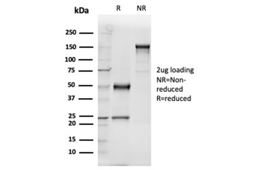 SDS-PAGE - Anti-Vitamin D Binding Protein Antibody [VDBP/4481] (A277625) - Antibodies.com