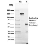 SDS-PAGE - Anti-Vitamin D Binding Protein Antibody [VDBP/4482] (A277626) - Antibodies.com