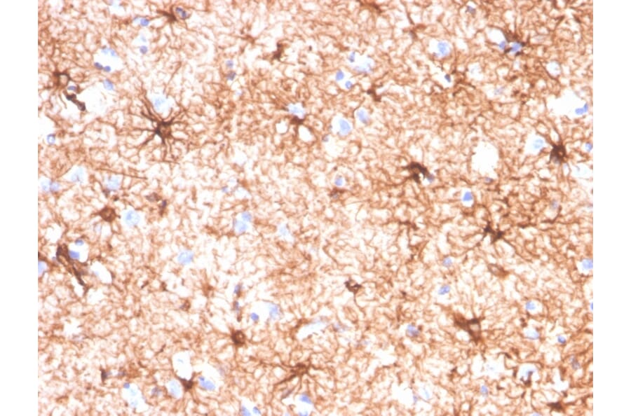 Immunohistochemistry - Anti-GFAP Antibody [GFAP/4450] (A277627) - Antibodies.com