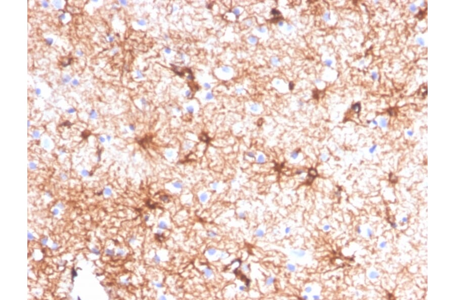 Immunohistochemistry - Anti-GFAP Antibody [GFAP/4450] (A277627) - Antibodies.com