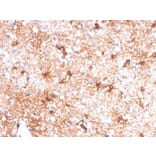 Immunohistochemistry - Anti-GFAP Antibody [GFAP/4450] (A277627) - Antibodies.com