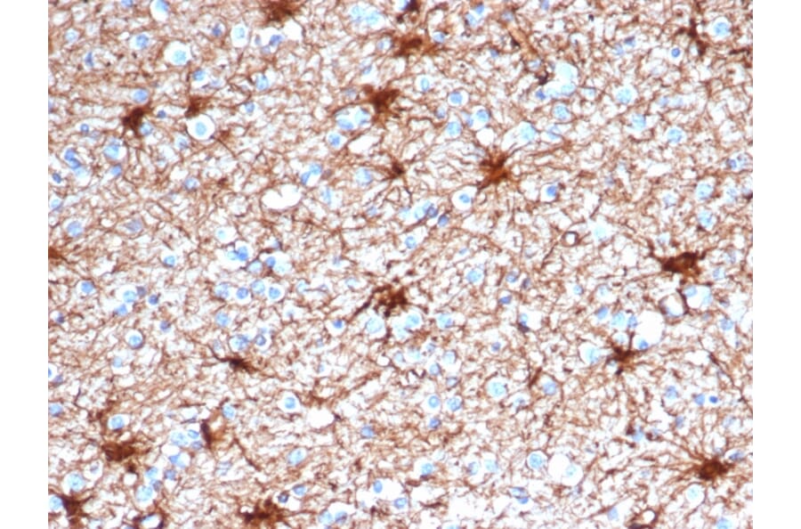Immunohistochemistry - Anti-GFAP Antibody [GFAP/4450] (A277627) - Antibodies.com