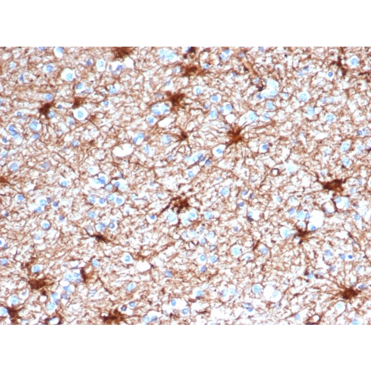 Immunohistochemistry - Anti-GFAP Antibody [GFAP/4450] (A277627) - Antibodies.com