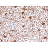 Immunohistochemistry - Anti-GFAP Antibody [GFAP/4450] (A277627) - Antibodies.com