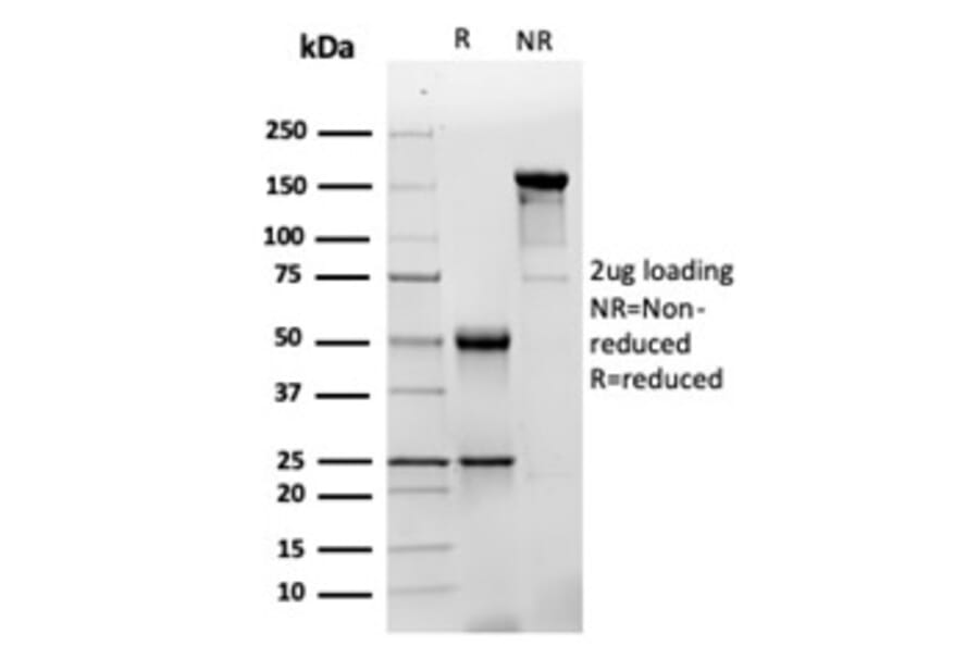 SDS-PAGE - Anti-GFAP Antibody [GFAP/4450] (A277627) - Antibodies.com