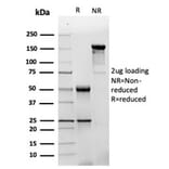 SDS-PAGE - Anti-GFAP Antibody [GFAP/4450] (A277627) - Antibodies.com